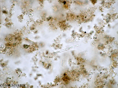 phyto/Tulear Lagoon/all/ICAR2 Avril 2008/Aulacoseira sp (Melosira sp-b)(copy)_thumb.jpg